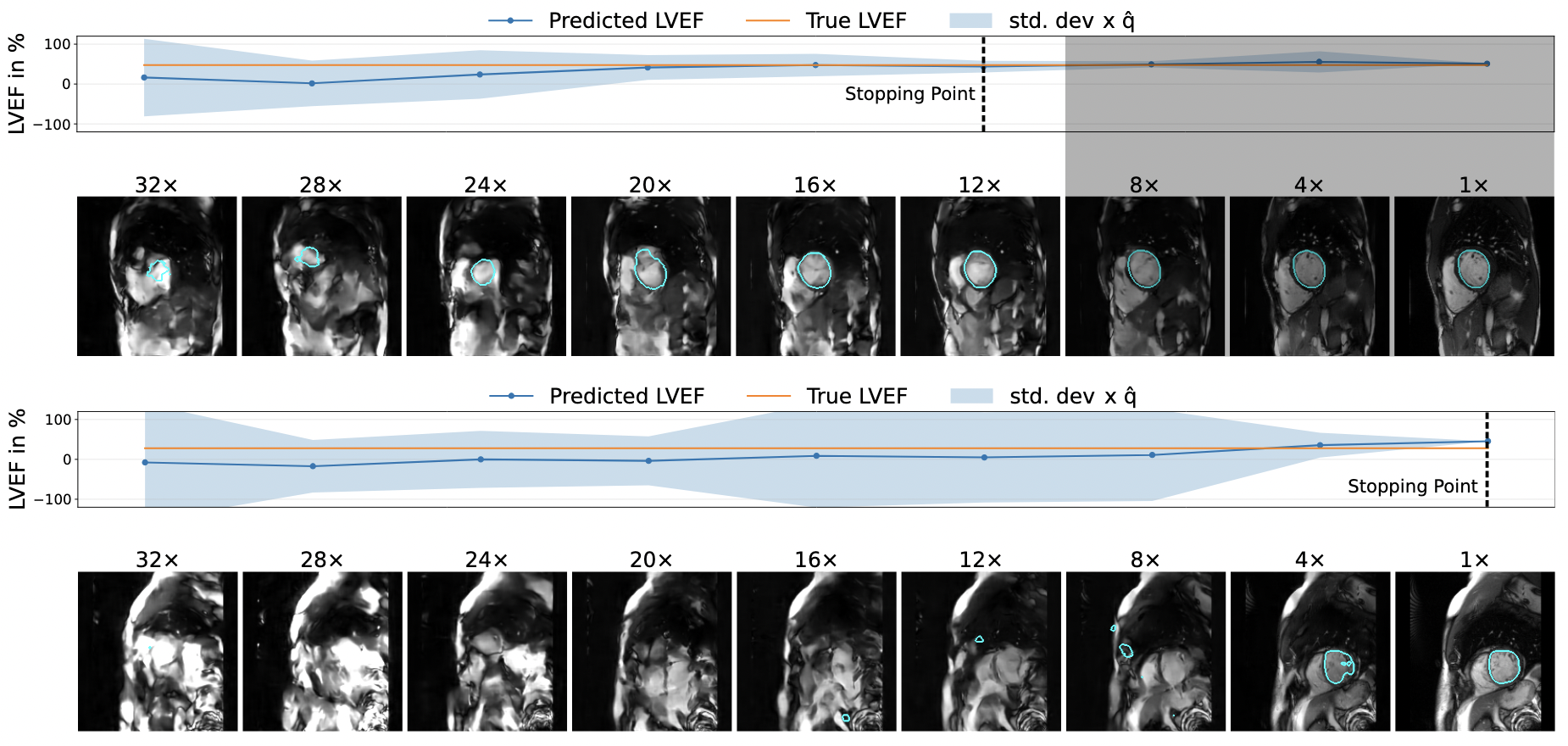 CUTE-MRI: Conformalized Uncertainty-based framework for Time-adaptivE MRI